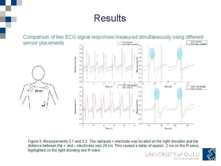 Results Comparison of two ECG signal responses measured simultaneously using different sensor placements Figure Results Comparison of two ECG signal responses measured simultaneously using different sensor placements Figure