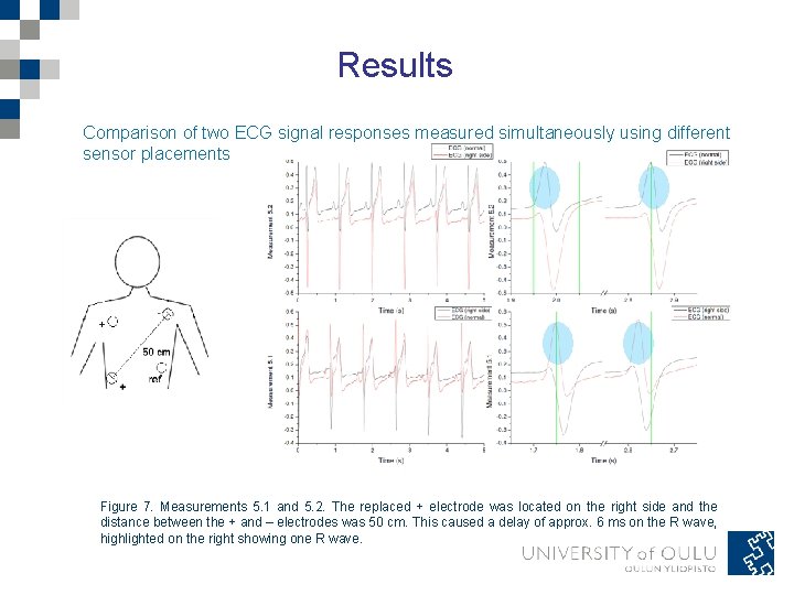 Results Comparison of two ECG signal responses measured simultaneously using different sensor placements Figure Results Comparison of two ECG signal responses measured simultaneously using different sensor placements Figure