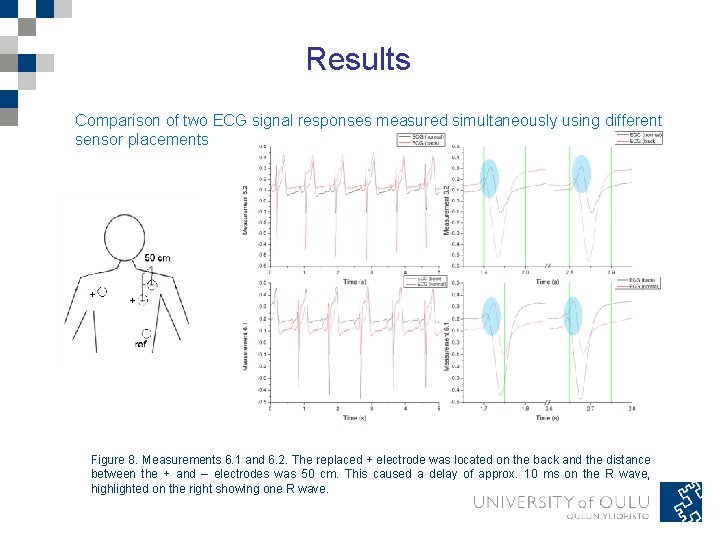 Results Comparison of two ECG signal responses measured simultaneously using different sensor placements Figure Results Comparison of two ECG signal responses measured simultaneously using different sensor placements Figure