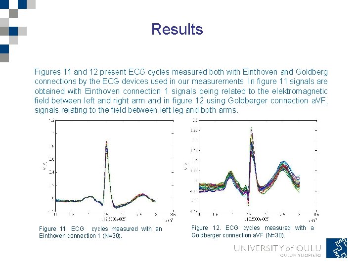 Results Figures 11 and 12 present ECG cycles measured both with Einthoven and Goldberg Results Figures 11 and 12 present ECG cycles measured both with Einthoven and Goldberg