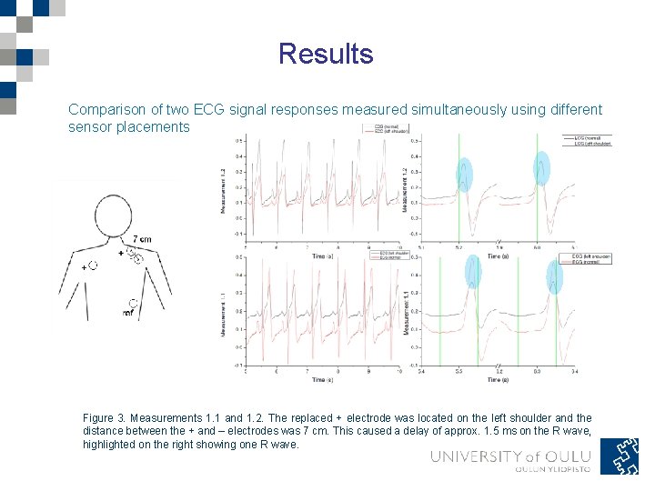 Results Comparison of two ECG signal responses measured simultaneously using different sensor placements Figure Results Comparison of two ECG signal responses measured simultaneously using different sensor placements Figure