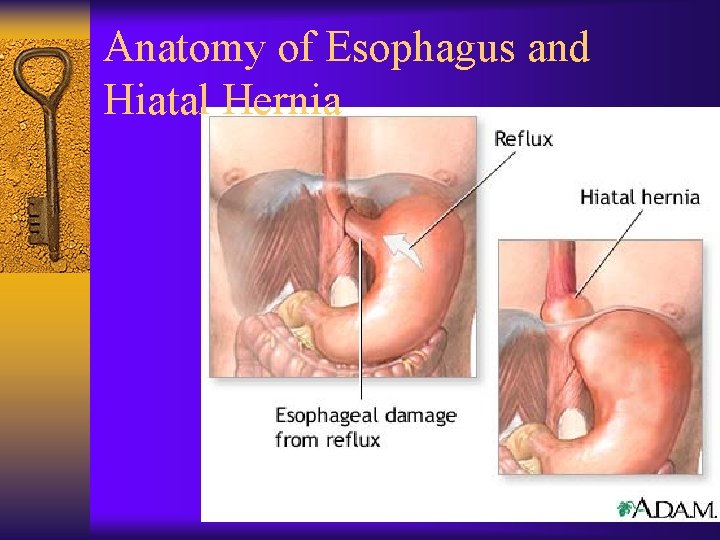 Anatomy of Esophagus and Hiatal Hernia 