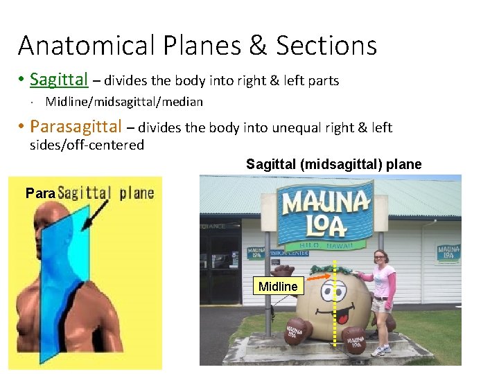 Anatomical Planes & Sections • Sagittal – divides the body into right & left