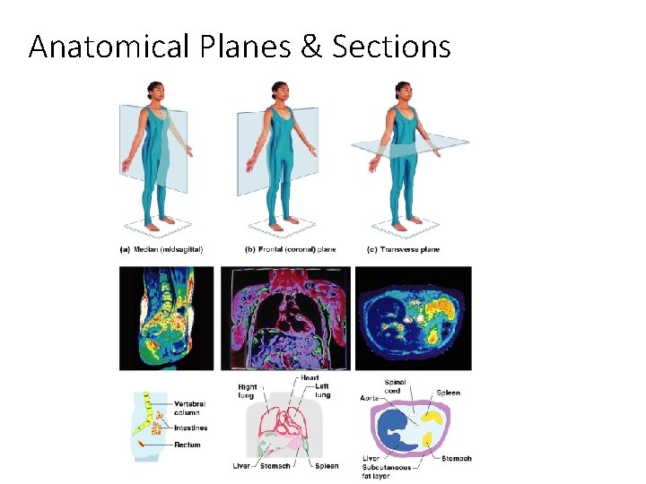 Anatomical Planes & Sections 