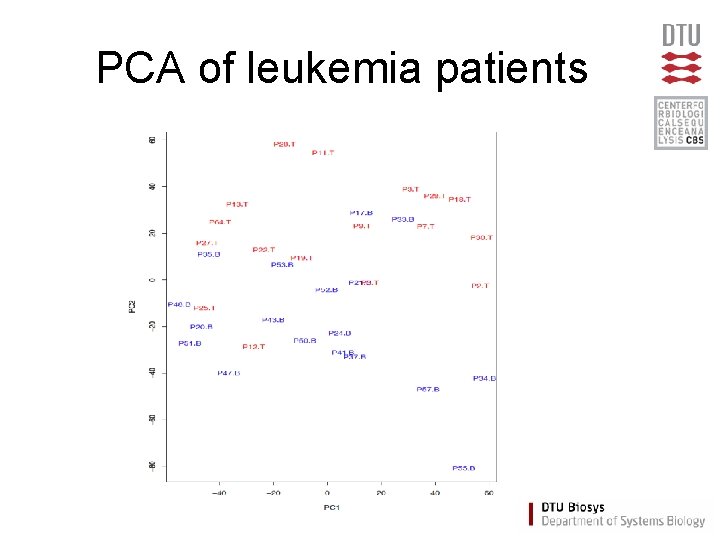 PCA of leukemia patients 