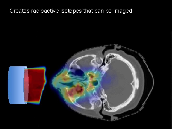 Proton from cyclotron patient’s tumor Createsbeam radioactive isotopessent thatto can be imaged 