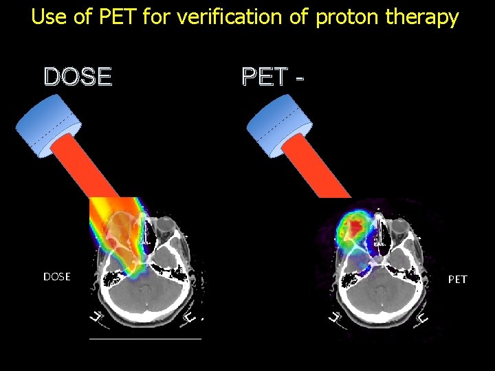 Use of PET for verification of proton therapy DOSE PET - PET 