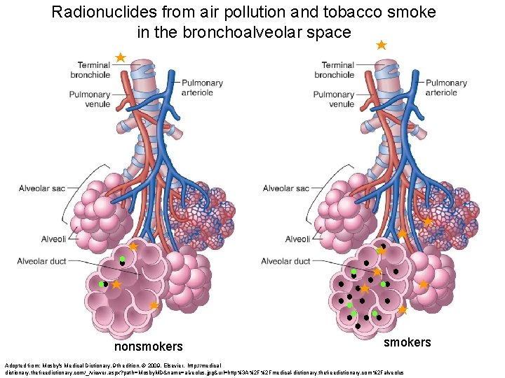 Radionuclides from air pollution and tobacco smoke in the bronchoalveolar space ⋆ ⋆ ⋆