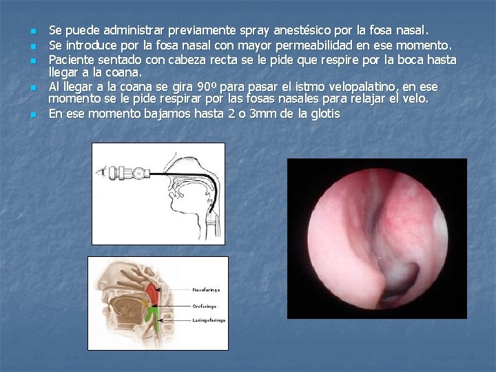 n n n Se puede administrar previamente spray anestésico por la fosa nasal. Se
