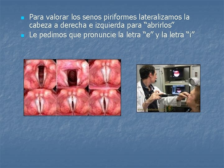 n n Para valorar los senos piriformes lateralizamos la cabeza a derecha e izquierda