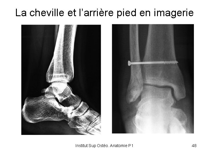 La cheville et l’arrière pied en imagerie Institut Sup Ostéo. Anatomie P 1 48