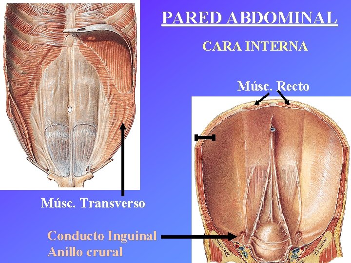 PARED ABDOMINAL CARA INTERNA Músc. Recto Músc. Transverso Conducto Inguinal Anillo crural 