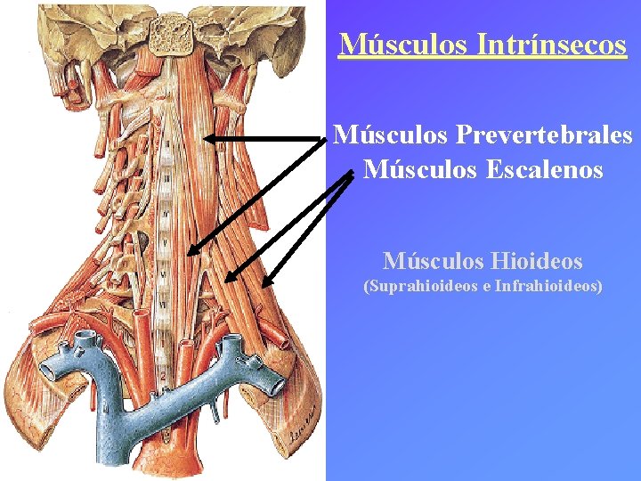 Músculos Intrínsecos Músculos Prevertebrales Músculos Escalenos Músculos Hioideos (Suprahioideos e Infrahioideos) 
