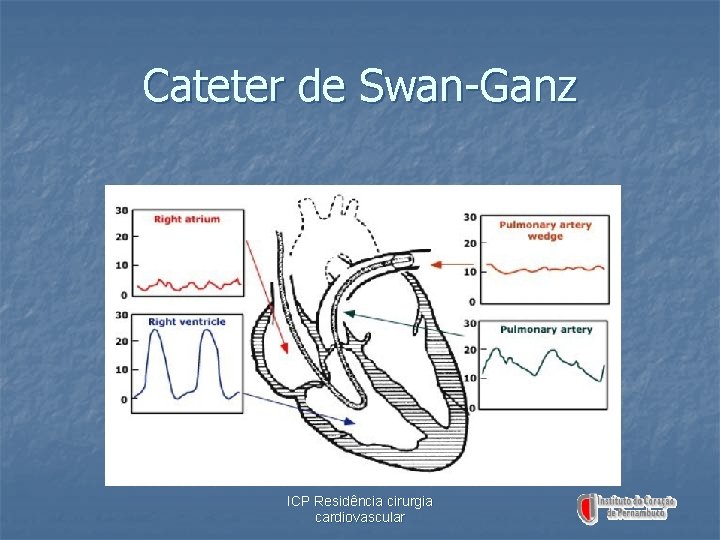Cateter de Swan-Ganz ICP Residência cirurgia cardiovascular 