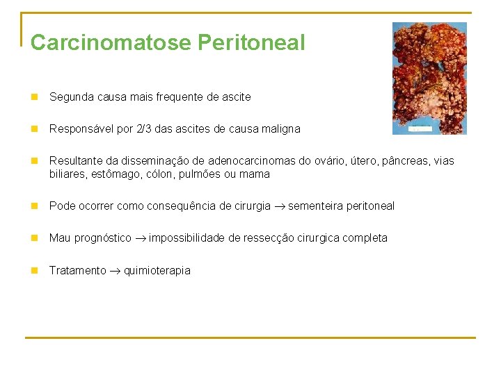 Carcinomatose Peritoneal n Segunda causa mais frequente de ascite n Responsável por 2/3 das