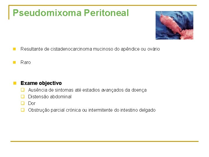 Pseudomixoma Peritoneal n Resultante de cistadenocarcinoma mucinoso do apêndice ou ovário n Raro n