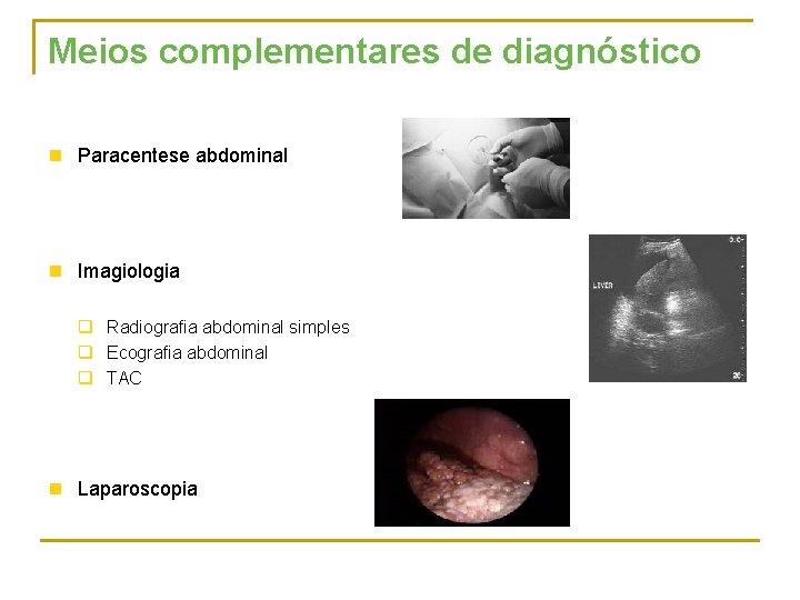 Meios complementares de diagnóstico n Paracentese abdominal n Imagiologia q Radiografia abdominal simples q