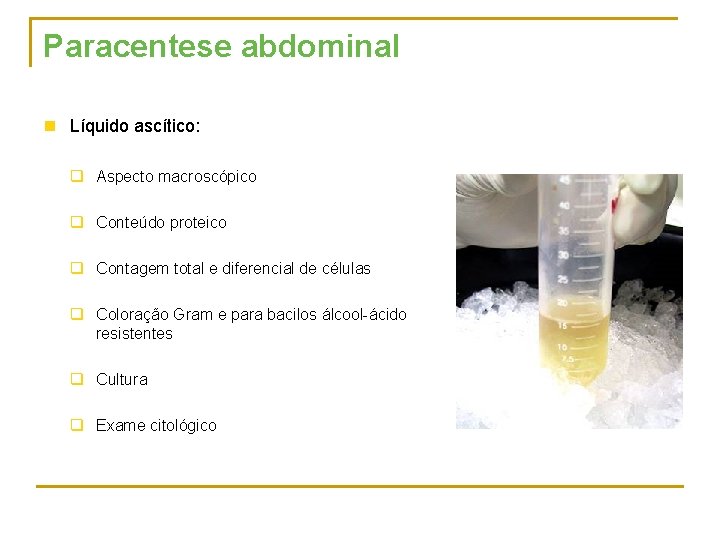Paracentese abdominal n Líquido ascítico: q Aspecto macroscópico q Conteúdo proteico q Contagem total