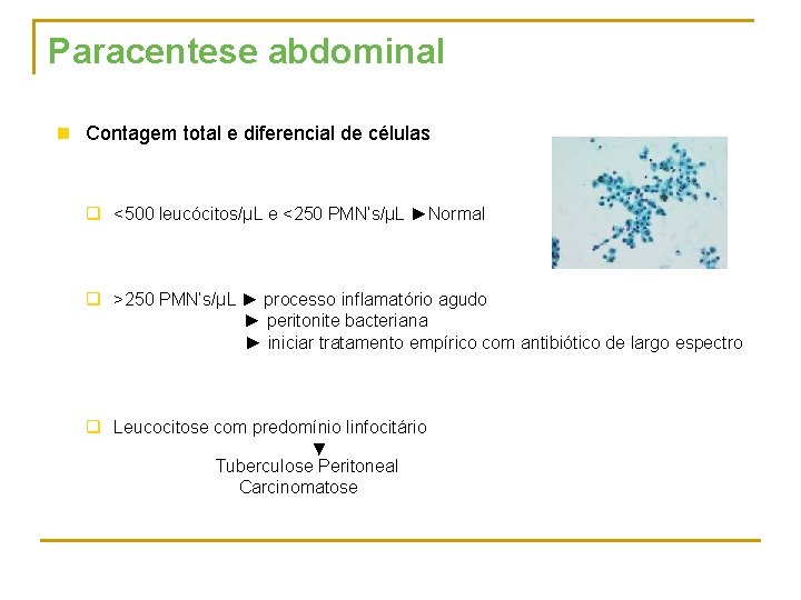 Paracentese abdominal n Contagem total e diferencial de células q <500 leucócitos/μL e <250