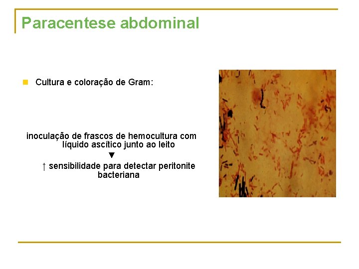 Paracentese abdominal n Cultura e coloração de Gram: inoculação de frascos de hemocultura com