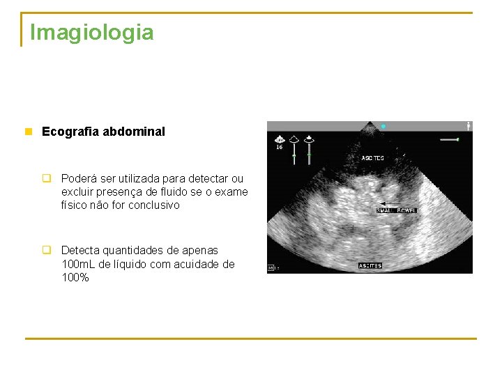 Imagiologia n Ecografia abdominal q Poderá ser utilizada para detectar ou excluir presença de