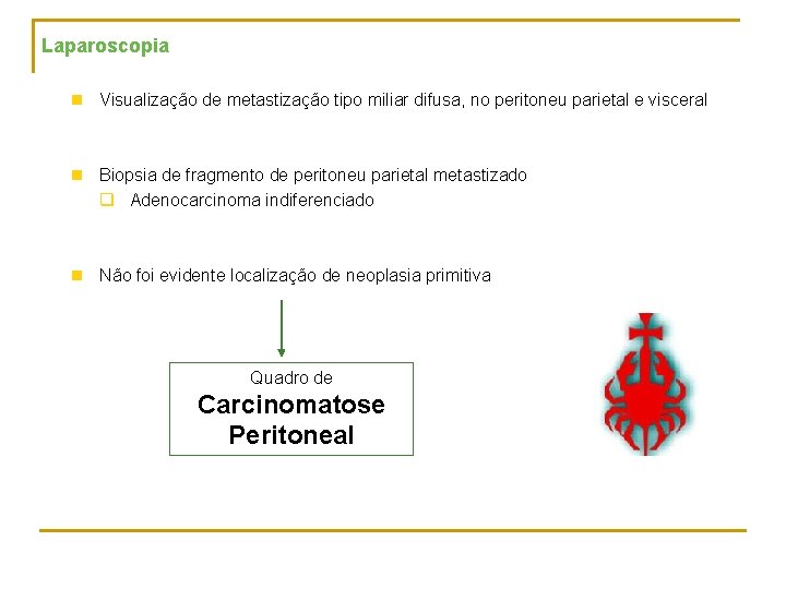 Laparoscopia n Visualização de metastização tipo miliar difusa, no peritoneu parietal e visceral n