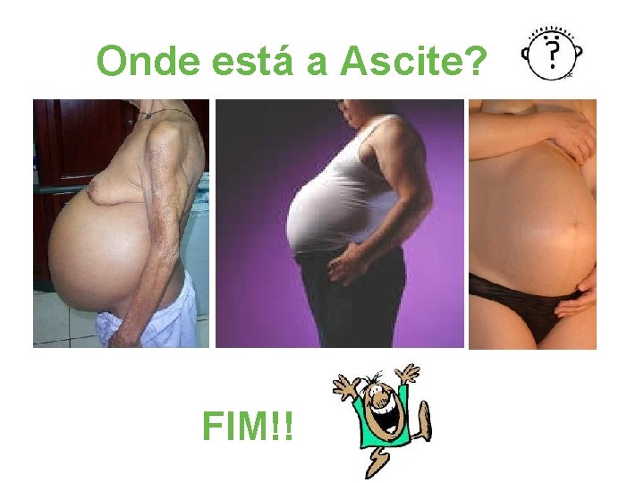 Onde está a Ascite? FIM!! 