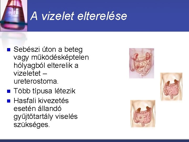 eritrociták vizelet prosztatitis