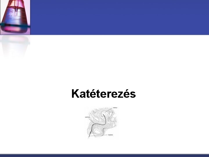 Katéterezés 