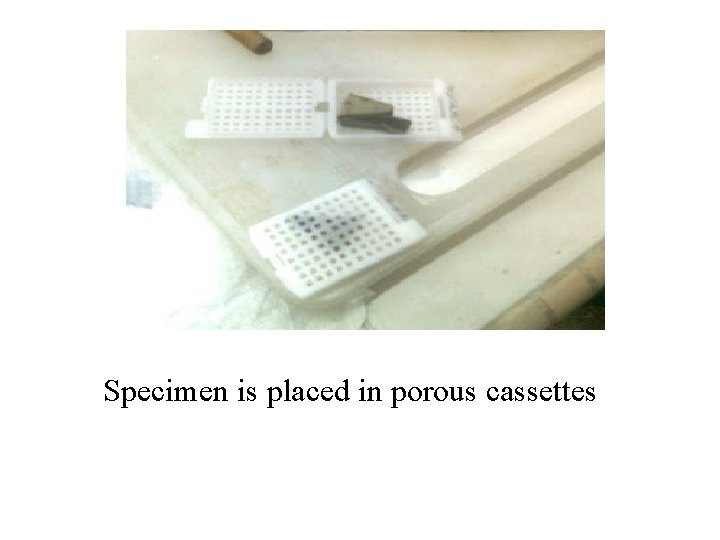 Specimen is placed in porous cassettes Specimen is placed in porous cassettes