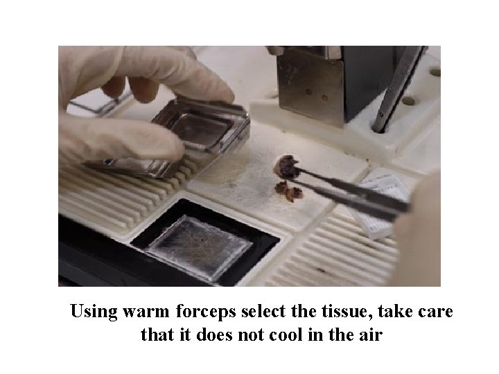 Using warm forceps select the tissue, take care that it does not cool in Using warm forceps select the tissue, take care that it does not cool in