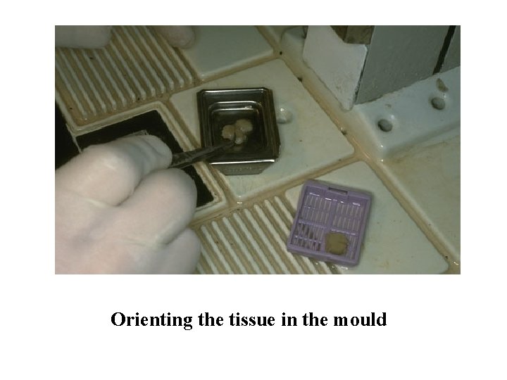 Orienting the tissue in the mould 