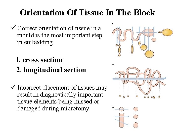 Orientation Of Tissue In The Block ü Correct orientation of tissue in a mould Orientation Of Tissue In The Block ü Correct orientation of tissue in a mould