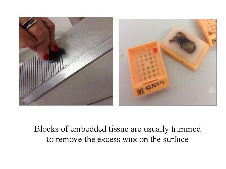 Blocks of embedded tissue are usually trimmed to remove the excess wax on the