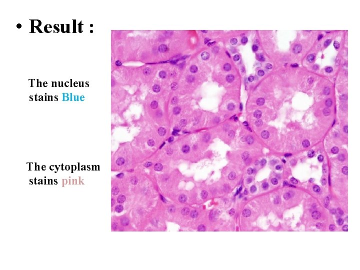  • Result : The nucleus stains Blue The cytoplasm stains pink 