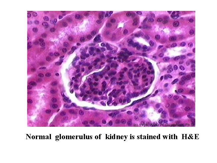 Normal glomerulus of kidney is stained with H&E Normal glomerulus of kidney is stained with H&E