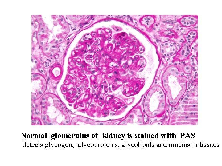 Normal glomerulus of kidney is stained with PAS detects glycogen, glycoproteins, glycolipids and mucins