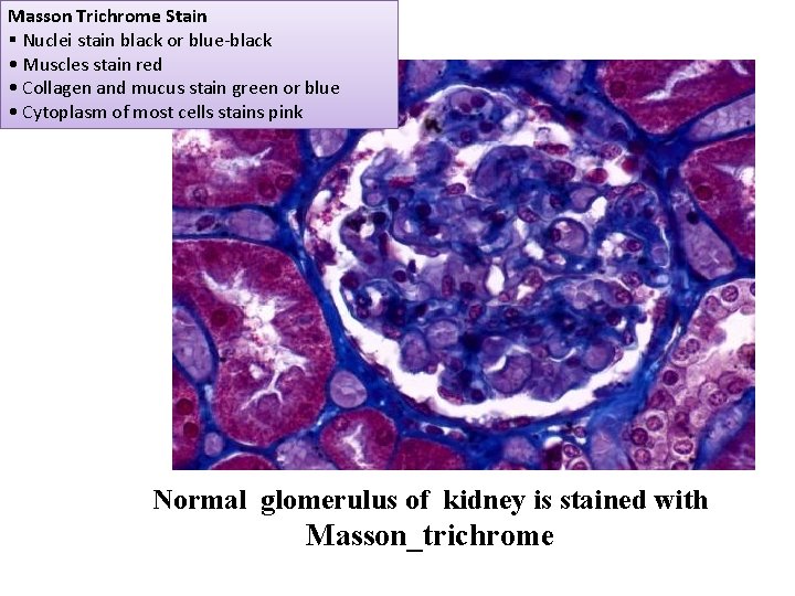 Masson Trichrome Stain § Nuclei stain black or blue-black • Muscles stain red • Masson Trichrome Stain § Nuclei stain black or blue-black • Muscles stain red •