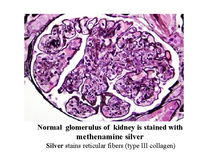 Normal glomerulus of kidney is stained with methenamine silver Silver stains reticular fibers (type