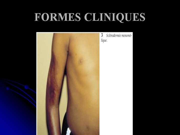 FORMES CLINIQUES 