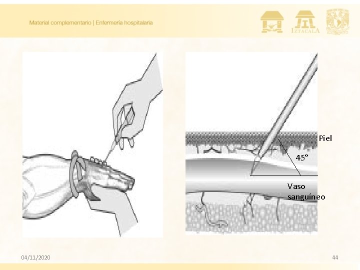 Piel 45° Vaso sanguíneo 04/11/2020 44 