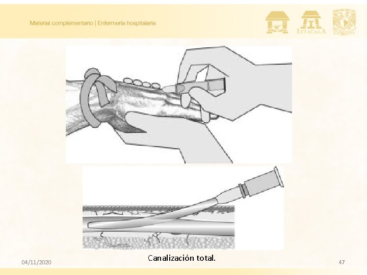 04/11/2020 Canalización total. 47 