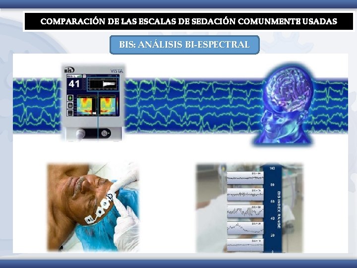 COMPARACIÓN DE LAS ESCALAS DE SEDACIÓN COMUNMENTE USADAS BIS: ANÁLISIS BI-ESPECTRAL 