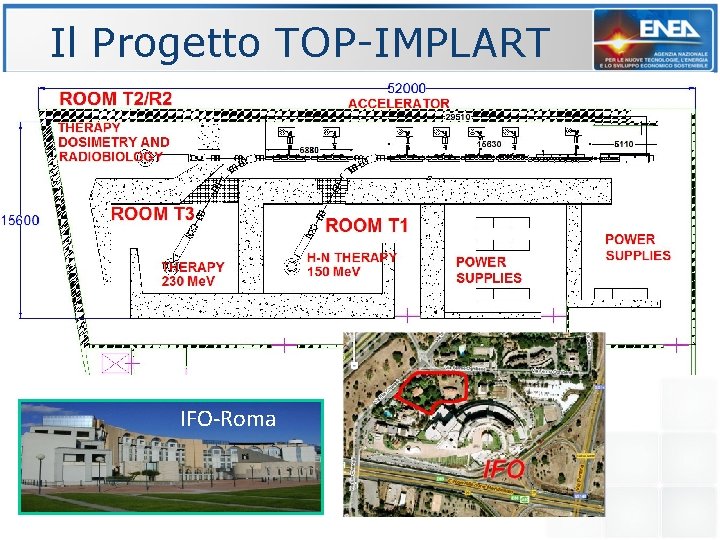 Il Progetto TOP-IMPLART IFO-Roma 