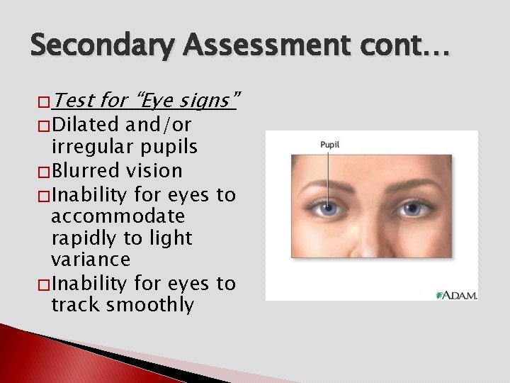 Secondary Assessment cont… � Test for “Eye signs” � Dilated and/or irregular pupils �