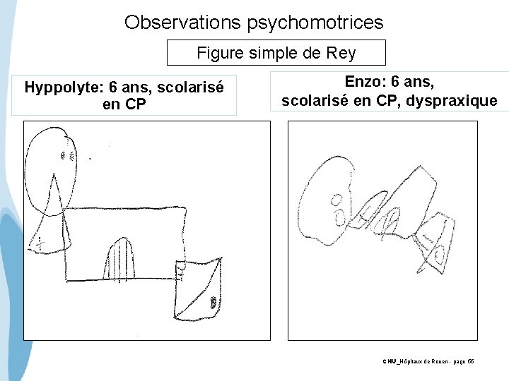 Observations psychomotrices Figure simple de Rey Hyppolyte: 6 ans, scolarisé en CP Enzo: 6