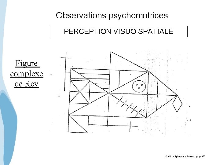  Observations psychomotrices PERCEPTION VISUO SPATIALE Figure complexe de Rey CHU_Hôpitaux de Rouen -