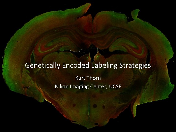 Genetically Encoded Labeling Strategies Kurt Thorn Nikon Imaging Center, UCSF 