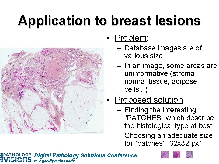 Application to breast lesions • Problem: – Database images are of various size –