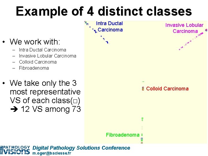 Example of 4 distinct classes Intra Ductal Carcinoma Invasive Lobular Carcinoma • We work